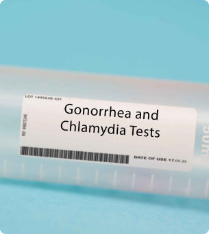 Chlamydia, Gonorroe, zelftest