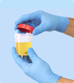 urine test