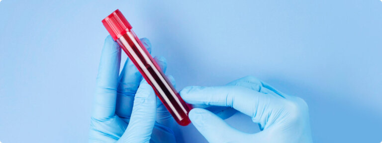 Algemeen bloedonderzoek: wat is het en wat wordt er getest? - Easly