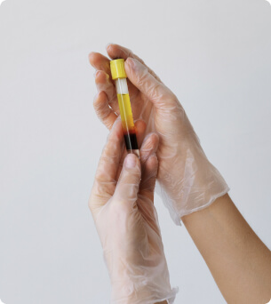 testtube