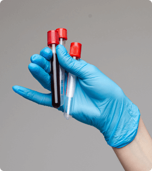 hand in latex handschoon die bloedbuisjes vasthoud