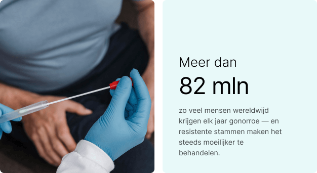 82 miljoen mensen krijgen gonorroe wereldwijd
